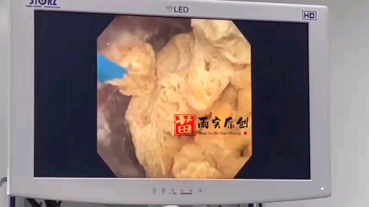 默认图片