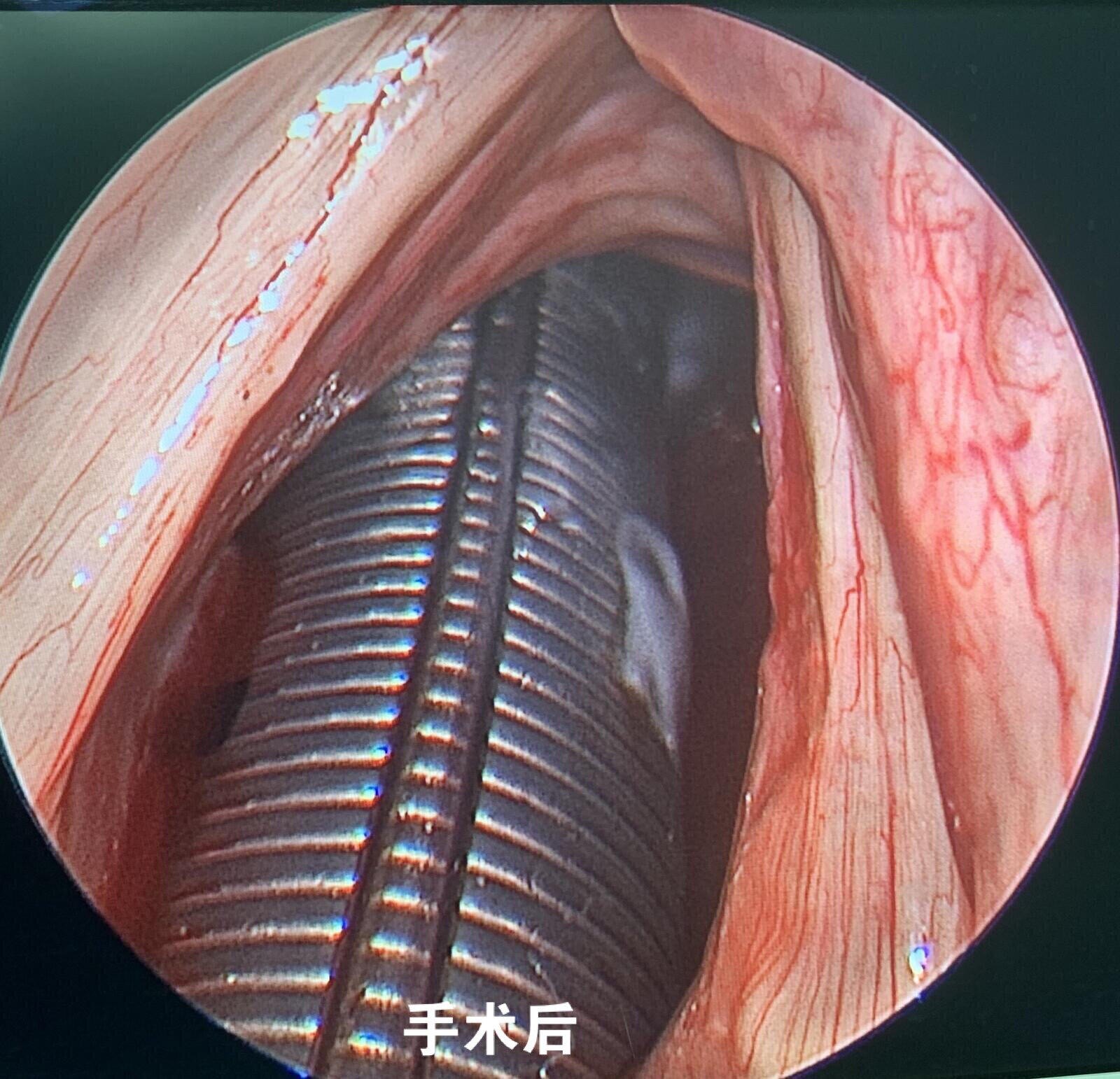 犬声带切除术教程图片