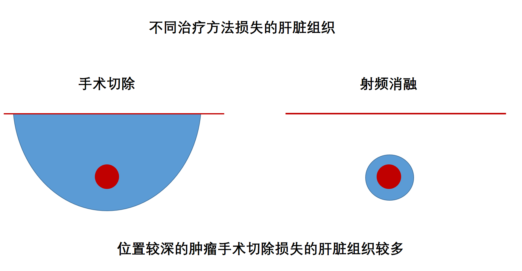 食用橄榄油可以预防妊娠纹吗（橄榄油去妊娠纹有效果吗）_玉环网