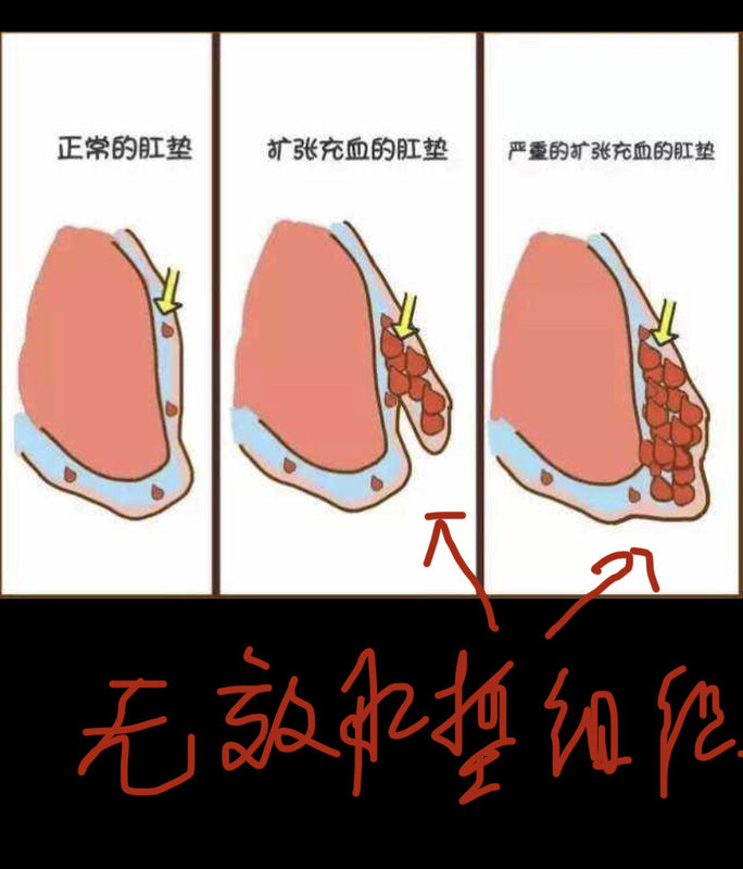圖文圖片