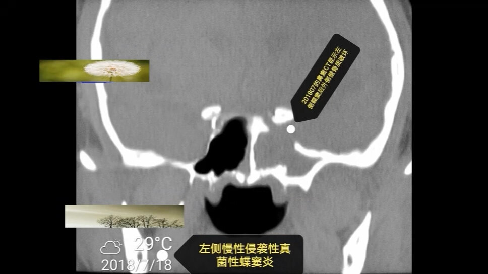 默认图片