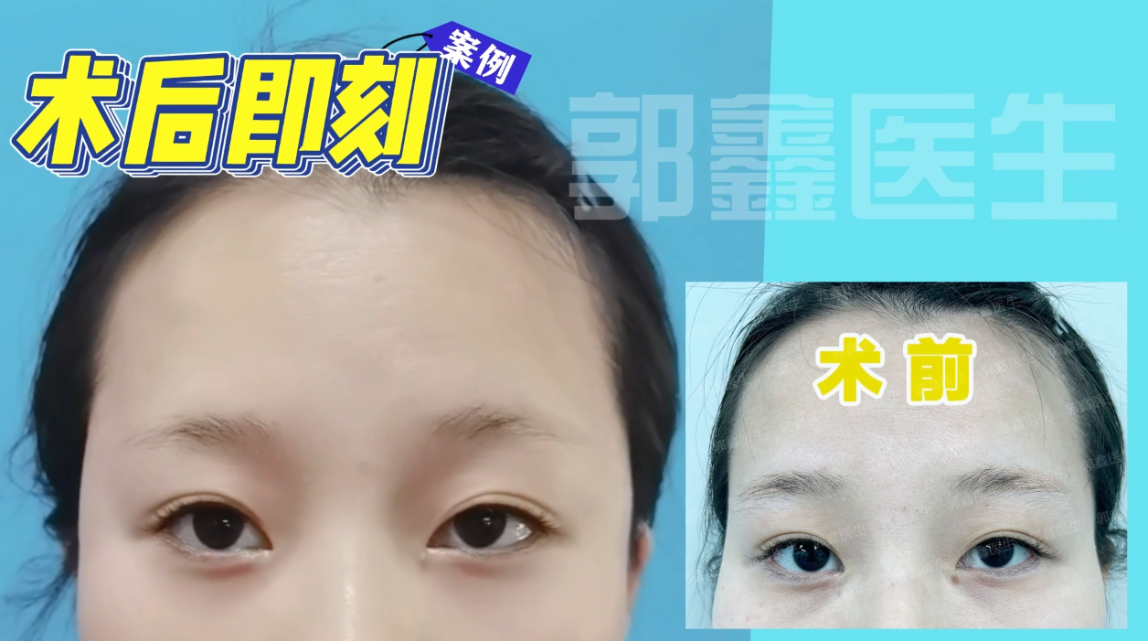 圖文圖片