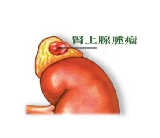 圖文圖片