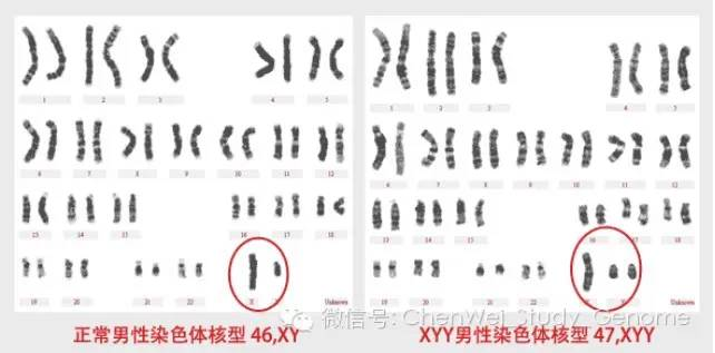 差了一条性染色体的女人和男人