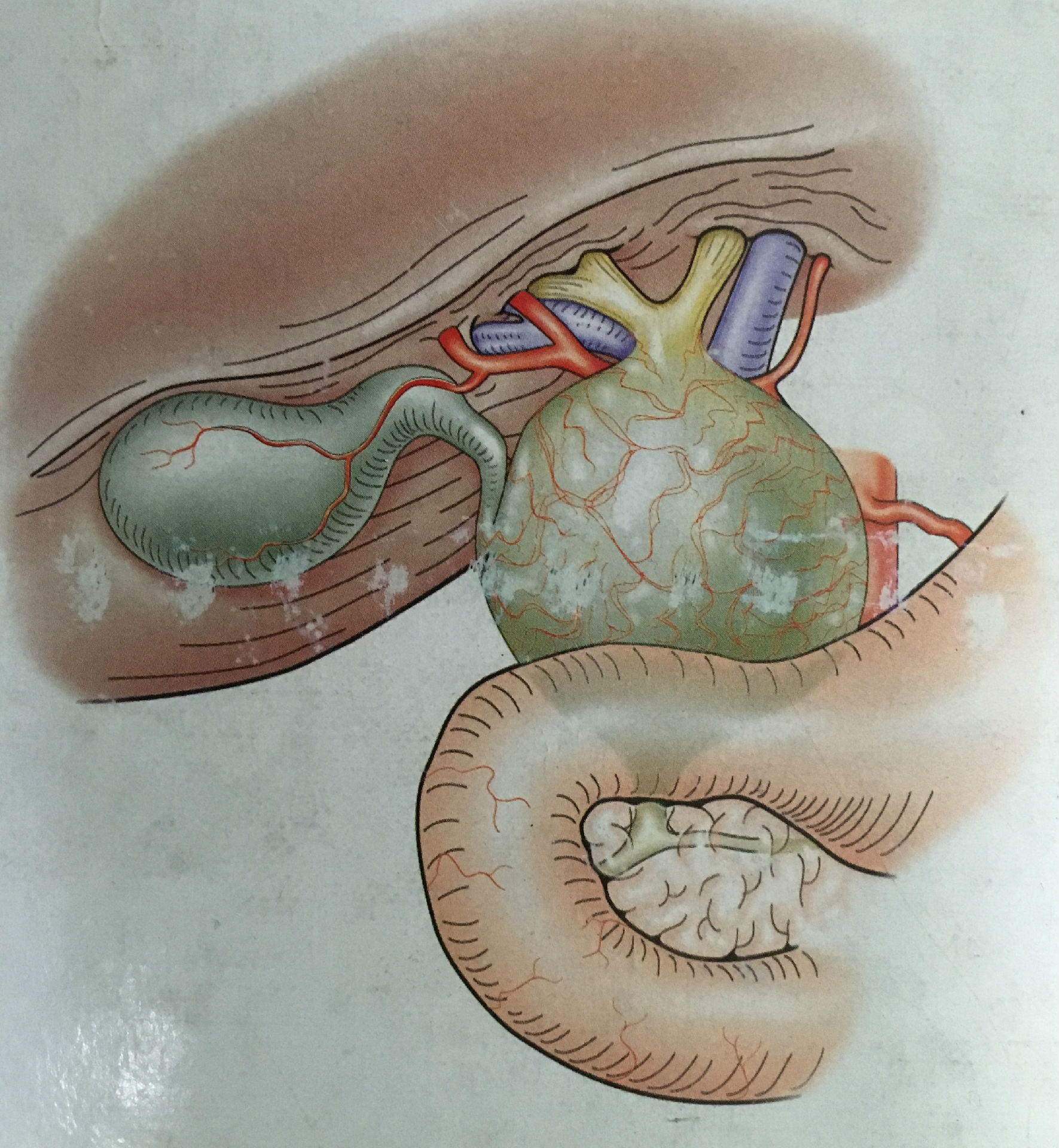 胎儿胆囊图片清晰图片图片