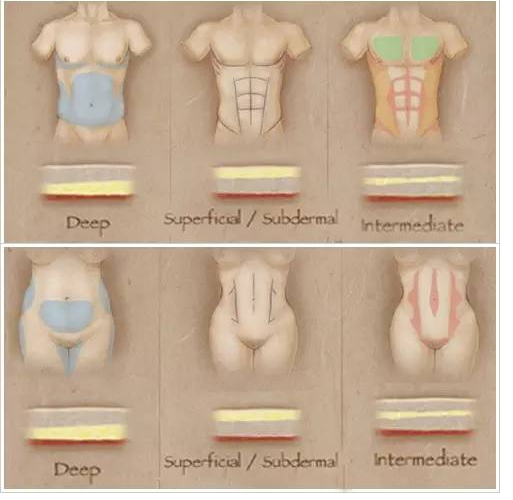 腹肌也能 整 出来