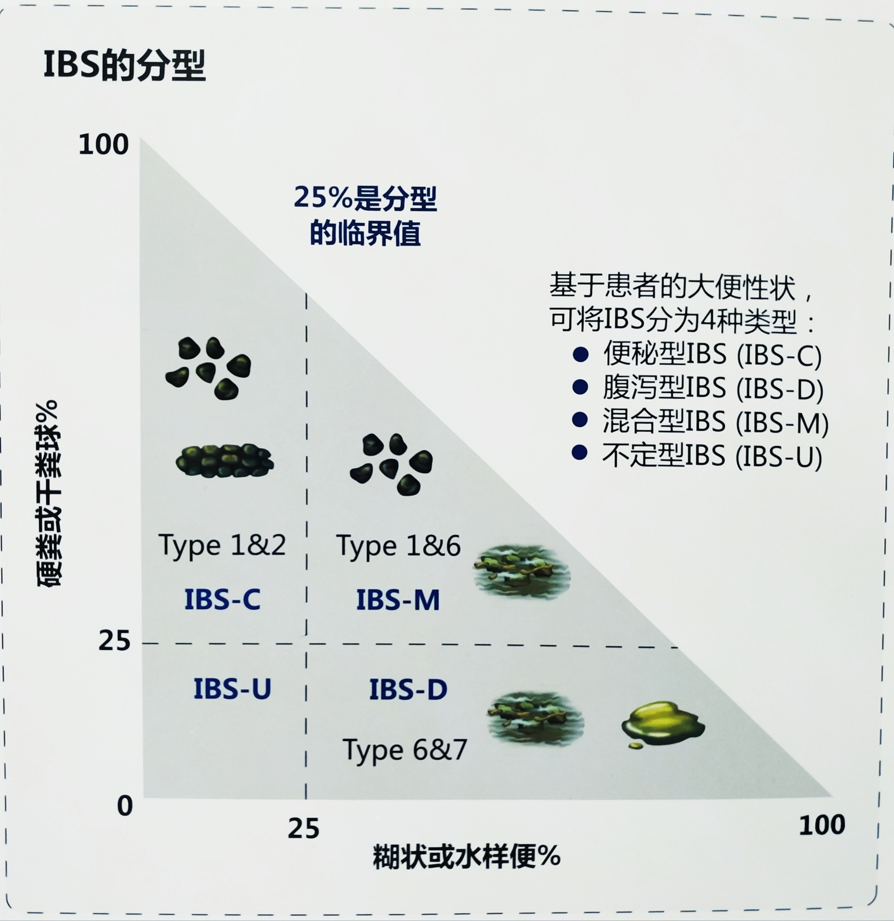 肠易激惹综合征(ibs)——症状诊断!