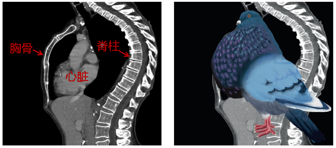 男生鸡胸是什么样子图片