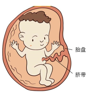 胎儿脐膨出图片