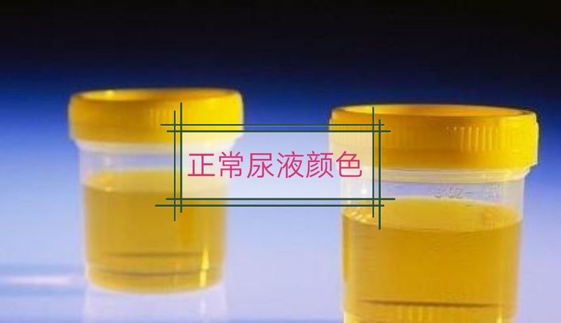 圖文圖片