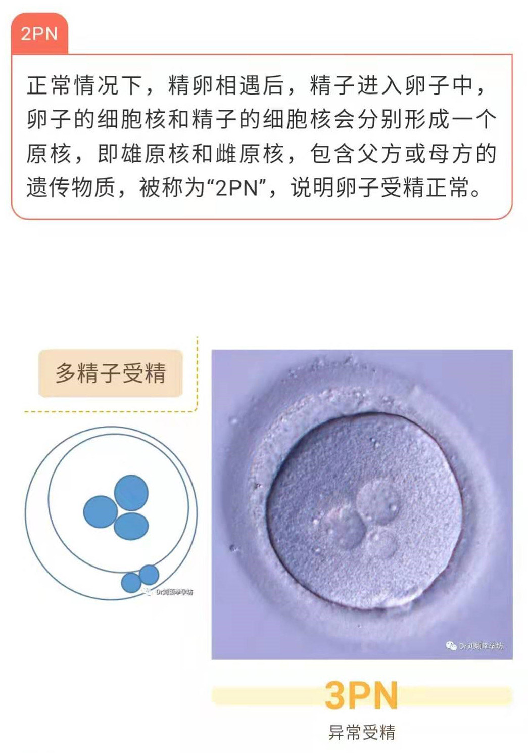 刘医生带您走进胚胎培养室2 什么样的受精卵可以用 试管婴儿 好大夫在线 刘医生带您走进胚胎培养室2 什么样的受精卵可以用 试管婴儿 好大夫在线