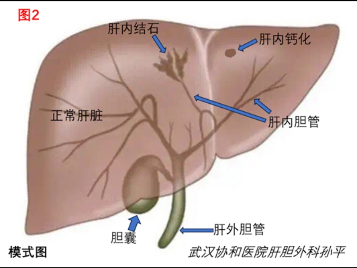 圖文圖片