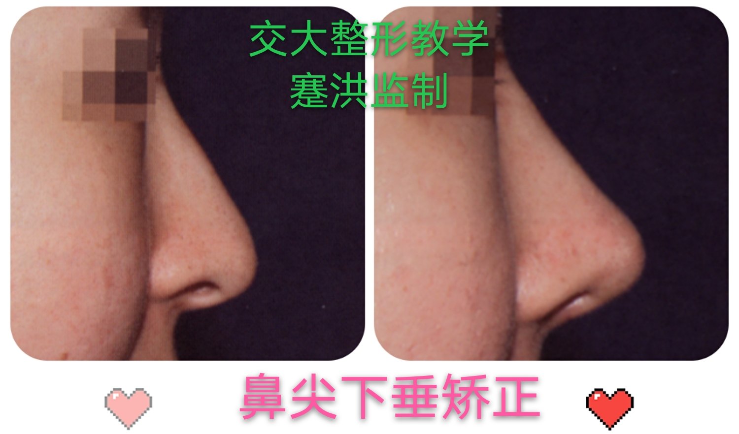 暂无