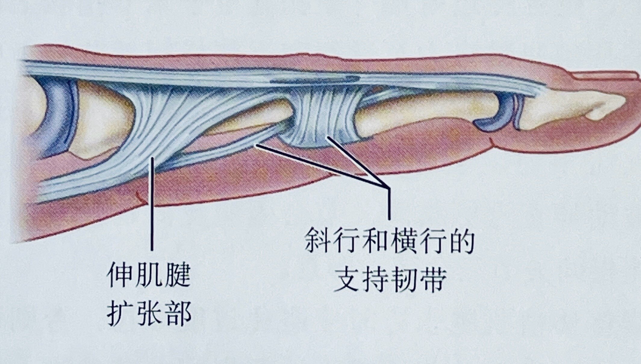 中央腱损伤之二纽孔畸形boutonniere畸形发生机制与对策探讨