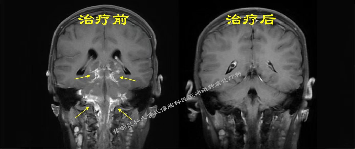 圖文圖片