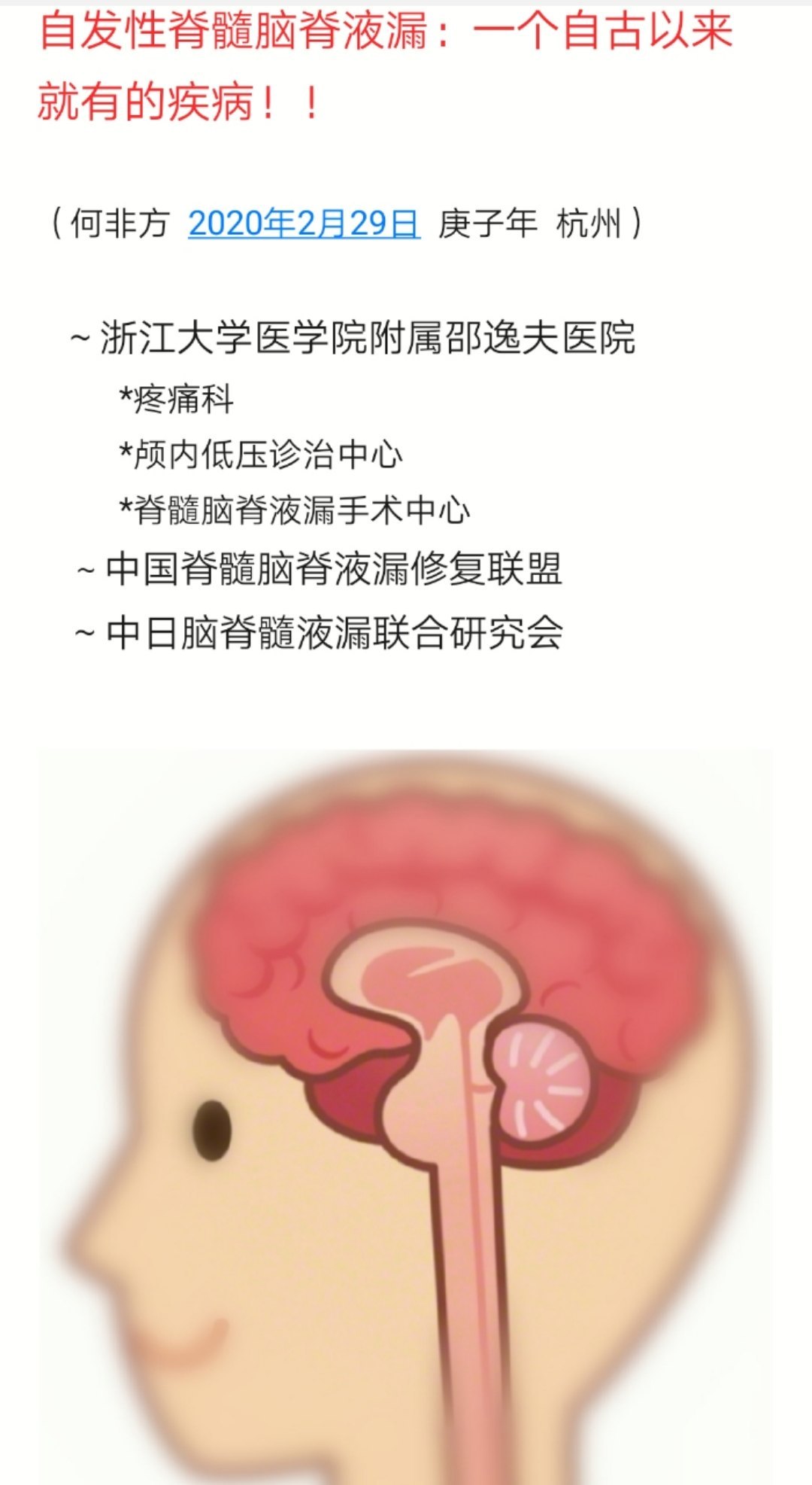 自发性脊髓脑脊液漏低颅压的科普2020年