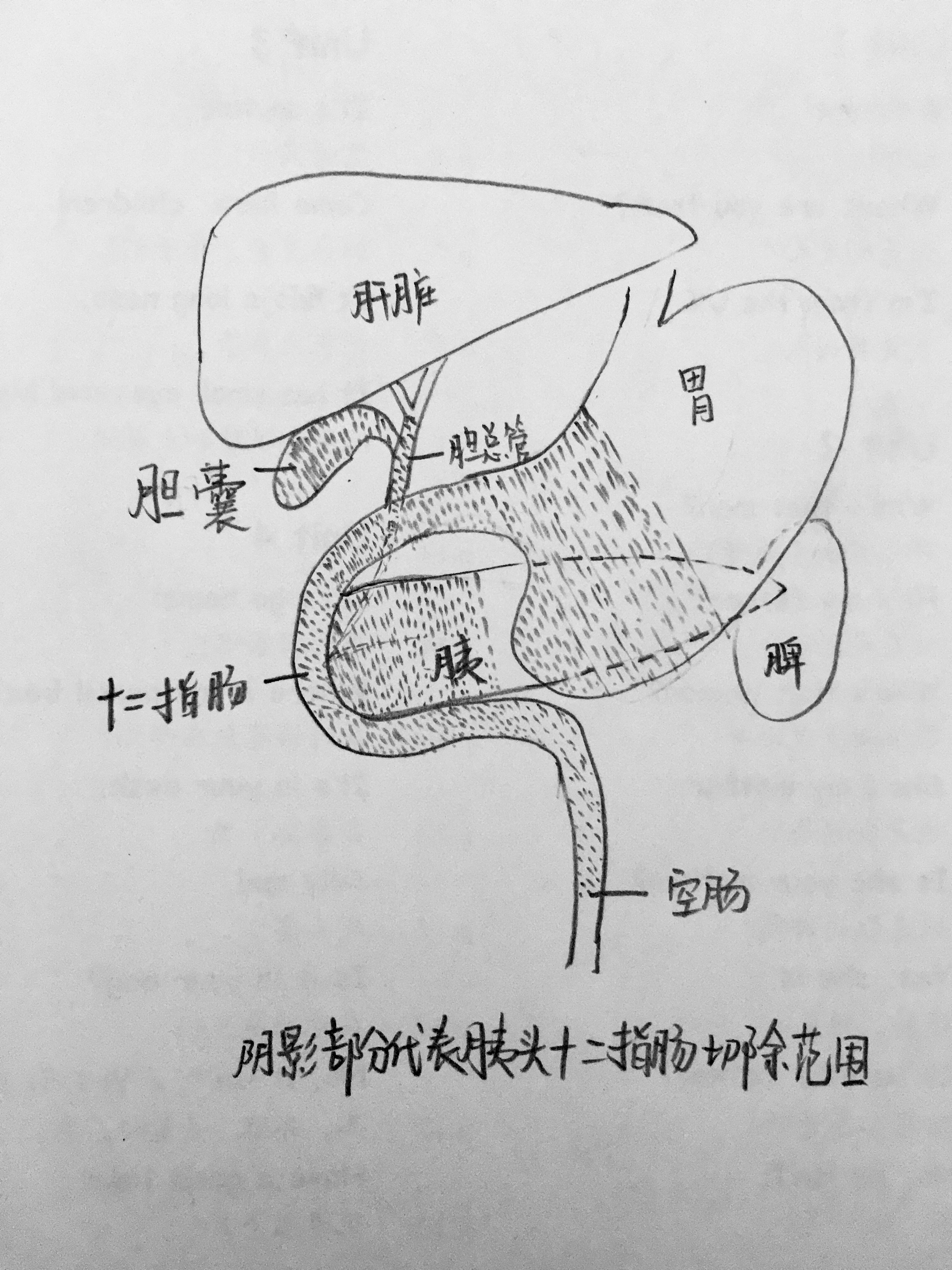 胰腺钩突与胰头解剖图图片