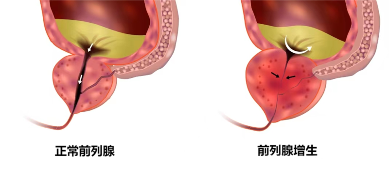 圖文圖片