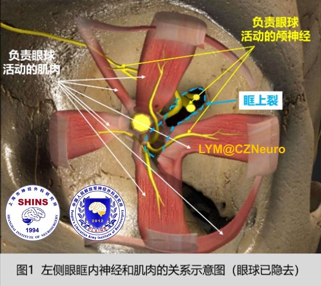 的上直肌,下直肌,内直肌,外直肌,以及上斜肌和下斜肌协调作用下完成的