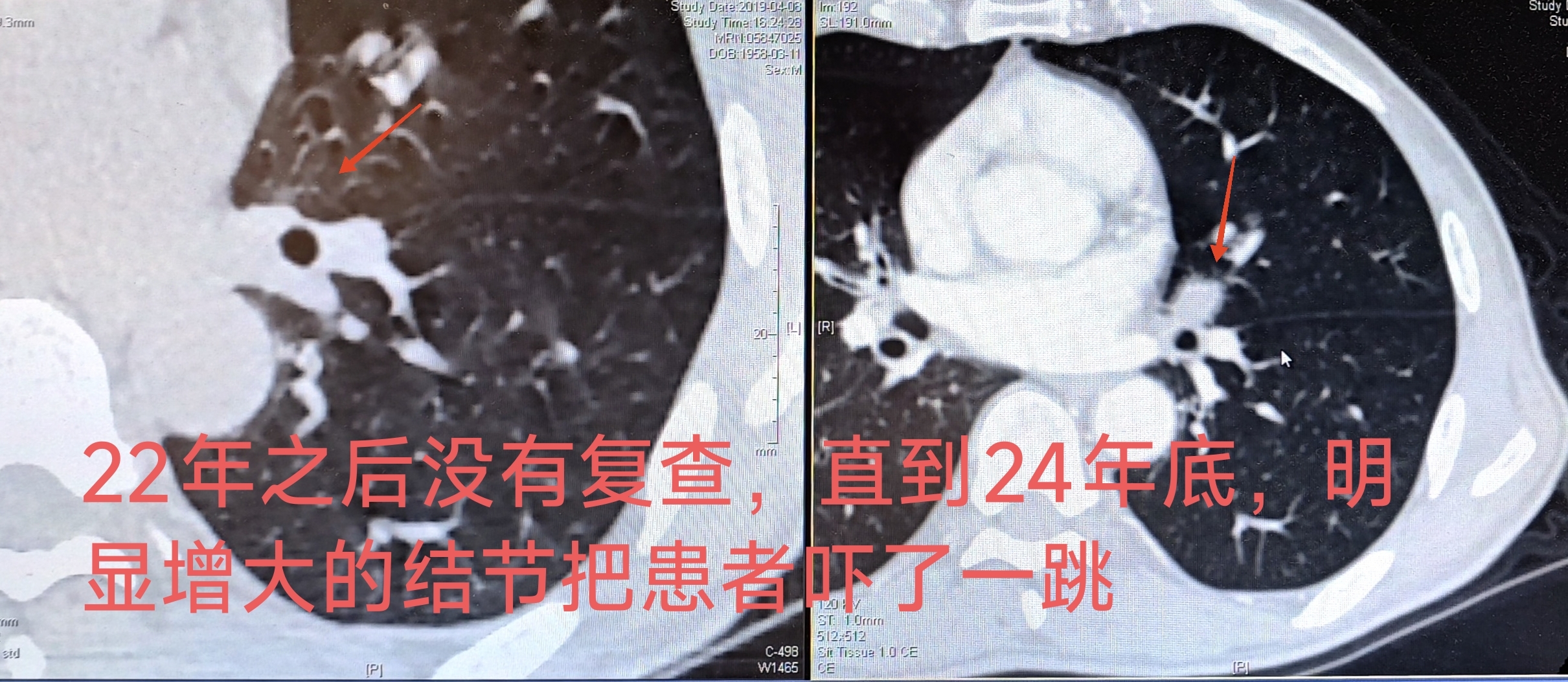 圖文圖片