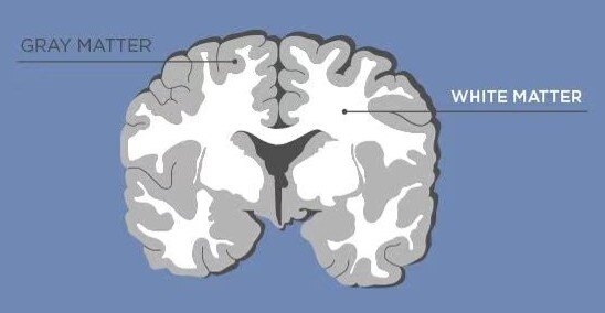 bodies ram 细胞体内存grey matter 灰质灰质对白质6