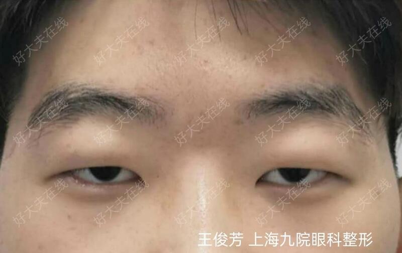 圖文圖片