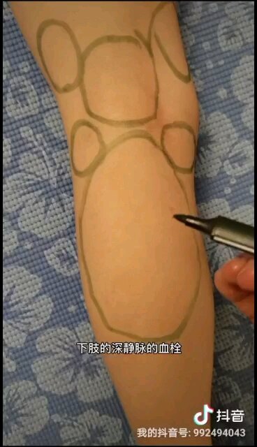 視頻封面