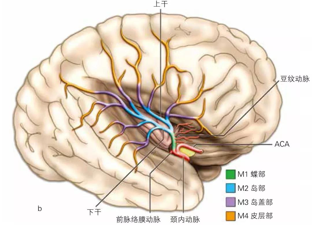 m5=为大脑中动脉的终末支-角回动脉.m4=即分叉段.