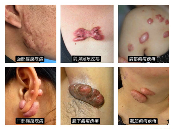 暂无