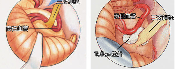 圖文圖片