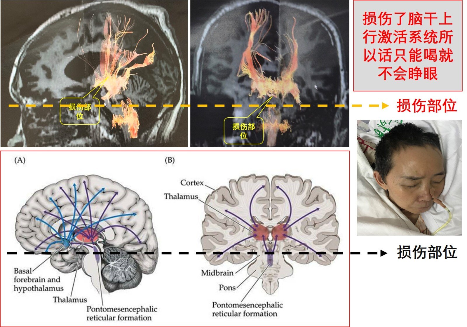 损伤的机制.jpg