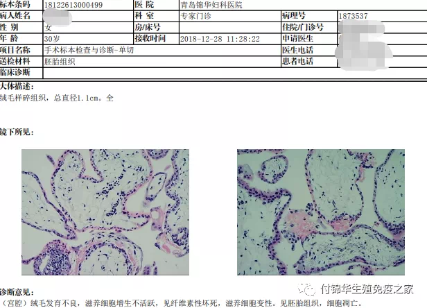 絨毛病理提示:(宮腔)絨毛髮育不良,滋養細胞增生不活躍,見纖維素性