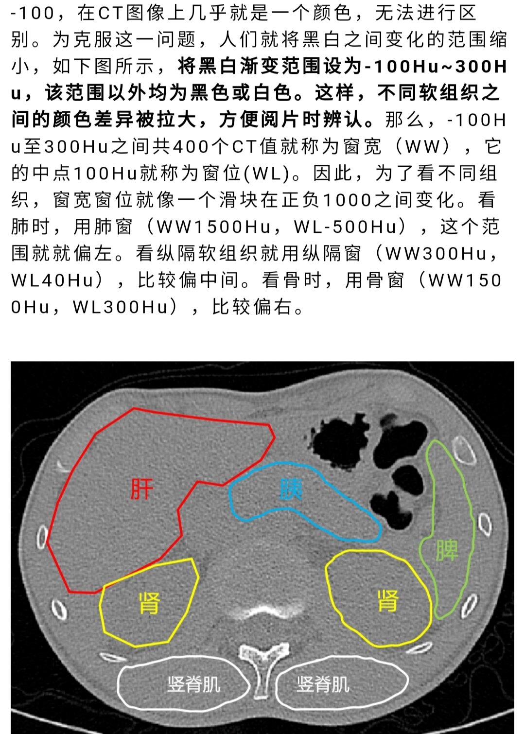 不做增強如何在平掃上鑑別肝囊腫和肝血管瘤肝膿腫