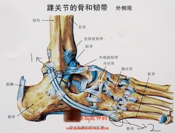 腓骨短肌腱在第五跖骨的附着位置常见的损伤部位小结