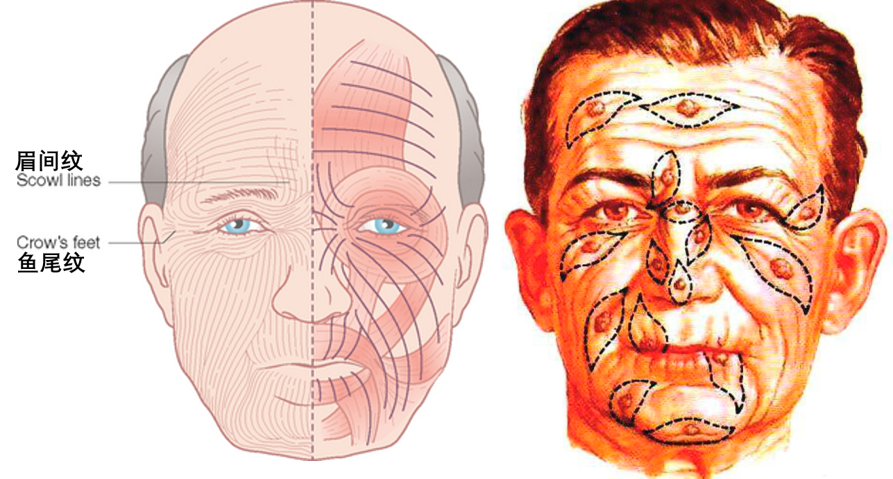 面部皮纹走向图片