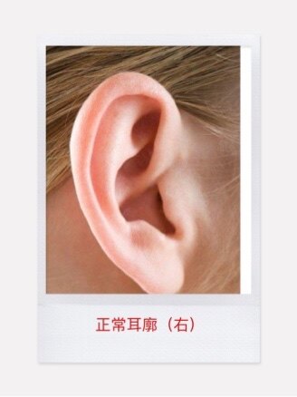 スキッパー無効にする完全に乾く耳殼ミネラルあなたは耳 スキッパー無効にする完全に乾く耳殼ミネラルあなたは耳