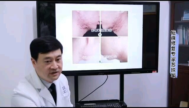 視頻封面