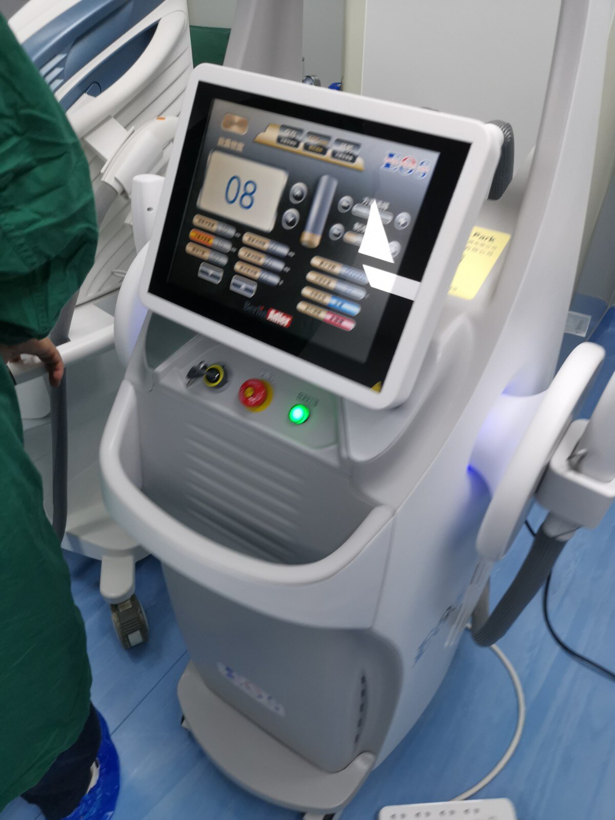 微创加脉冲光治疗霰粒肿治疗照片