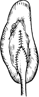 1609165804793936.png