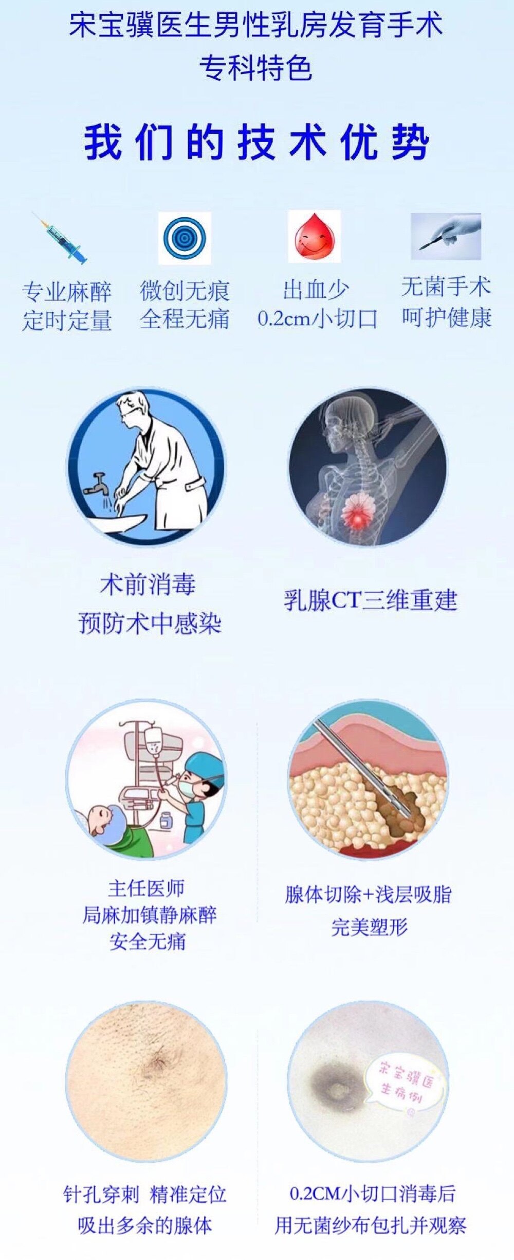 男性乳腺發育症微創手術切口在哪