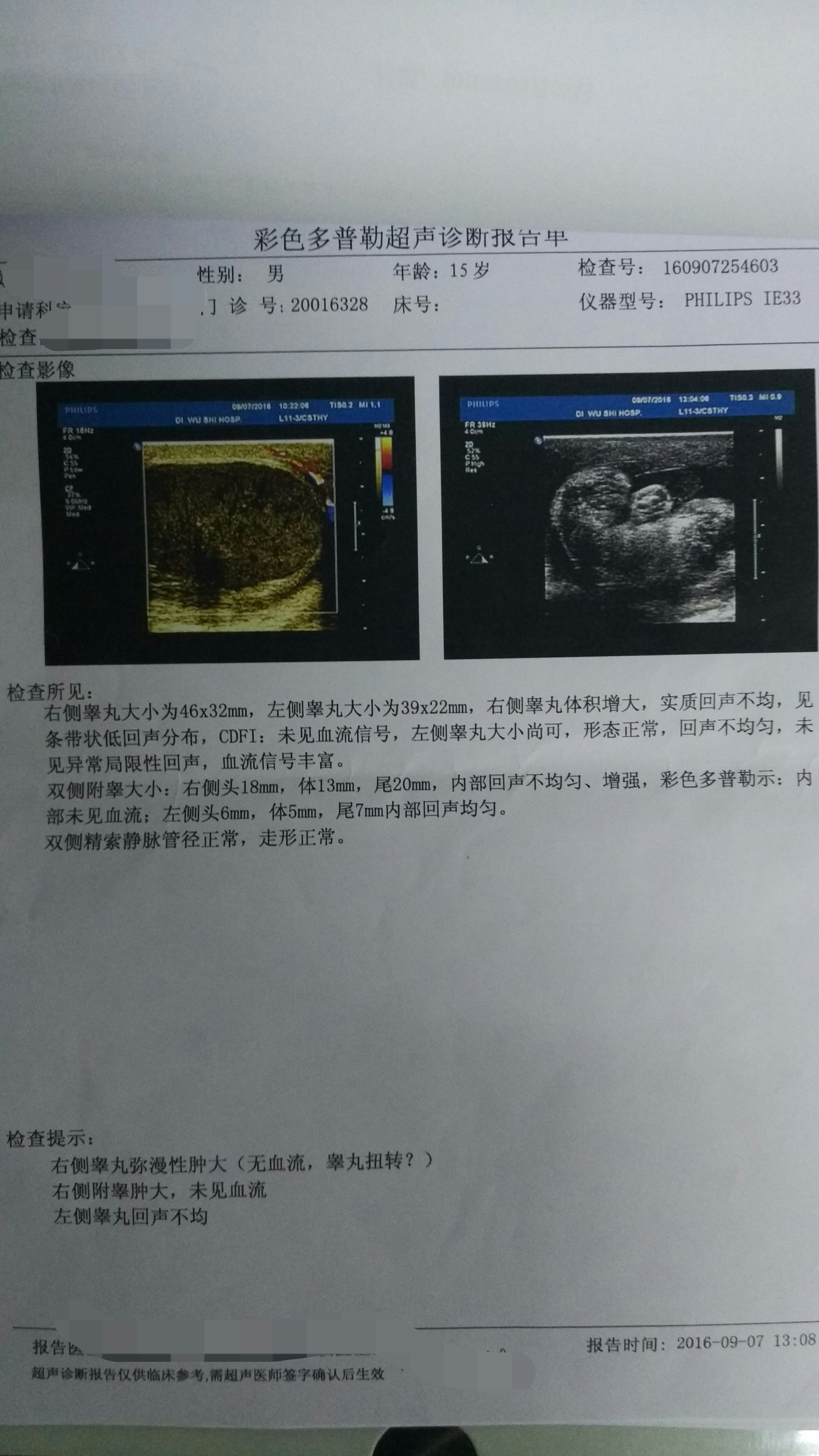 八个月男宝睾丸彩超图图片
