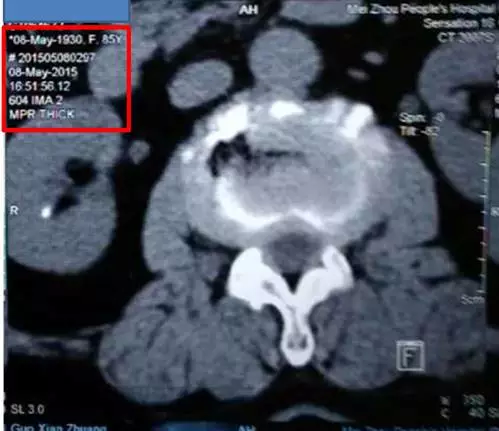 在家如何清晰拍照医学影像学图片上传给医生