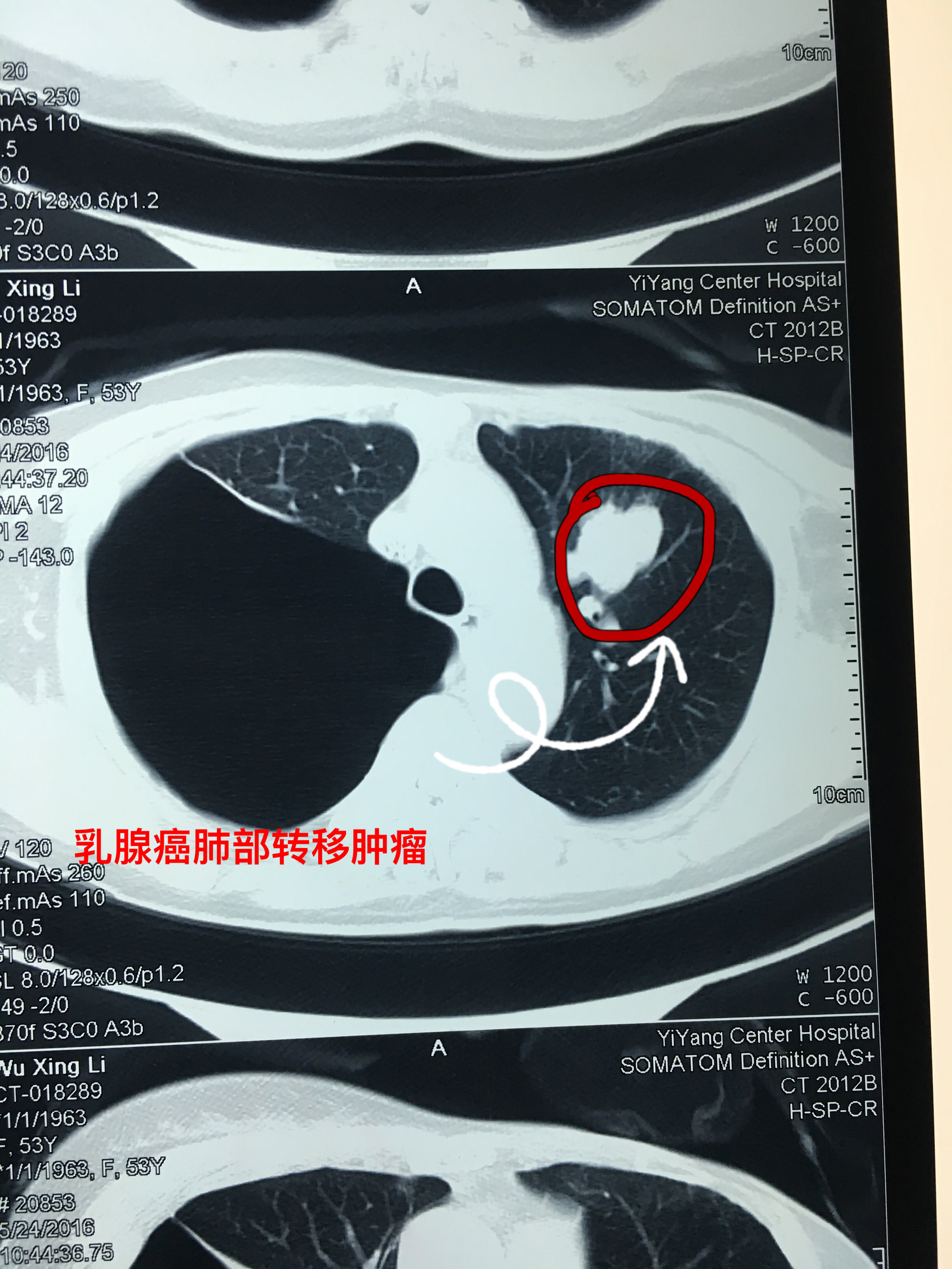 癌是怎样形成的_四种癌已经不是癌了_癌是肿瘤的意思吗