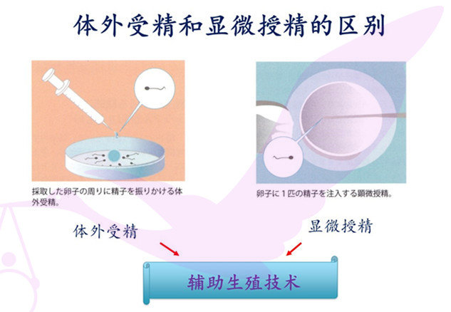 信不信由你 医生比你更关注二代试管的成功率