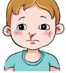 儿童鼻出血防止有妙招
