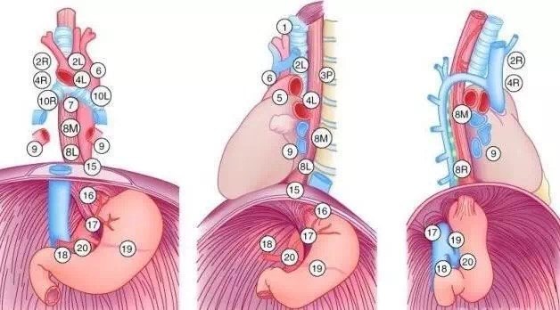 系统性的淋巴结的清扫是十分必要的,在我们切除食管,制作管状胃的同时