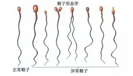 正常精子 参考图片