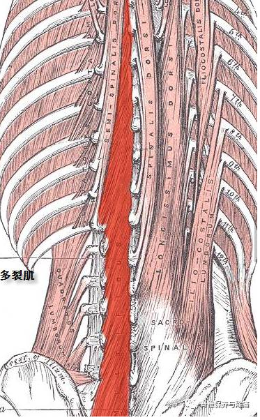 多裂肌萎缩性下腰痛