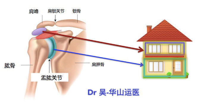 关于肩关节疼痛的一些解答及常见肩关节疾病