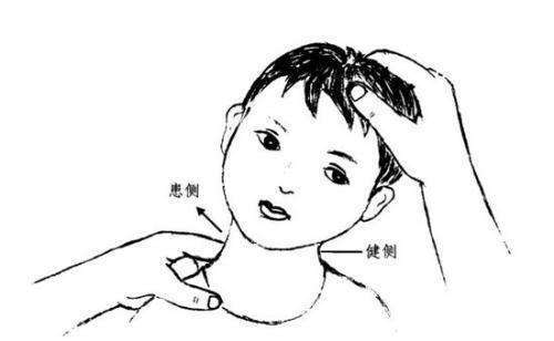 如何判断宝宝是否有斜颈?_斜颈_症状表现_检查 - 好大夫在线